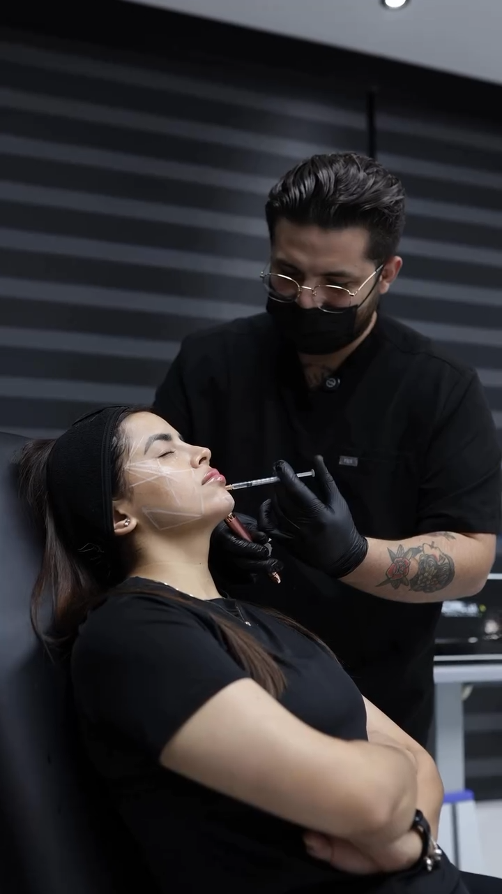 SKINBOOSTER FULL FACE