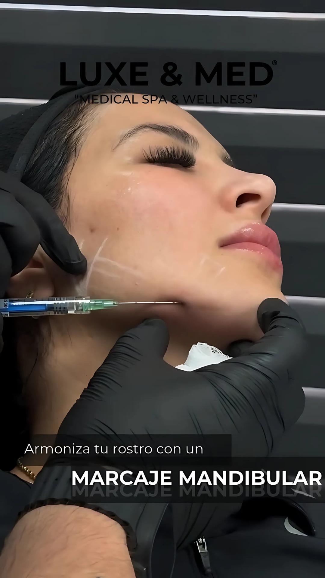 Photo by Lorenzo Herrera